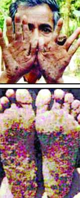 arsenic affected